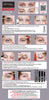 brow lift