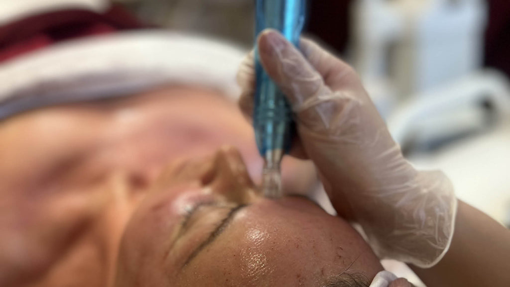 GP_micropen_7_2040x1150px.jpg__PID:bb7bb713-0632-4b6d-9883-fda6c82dcd04